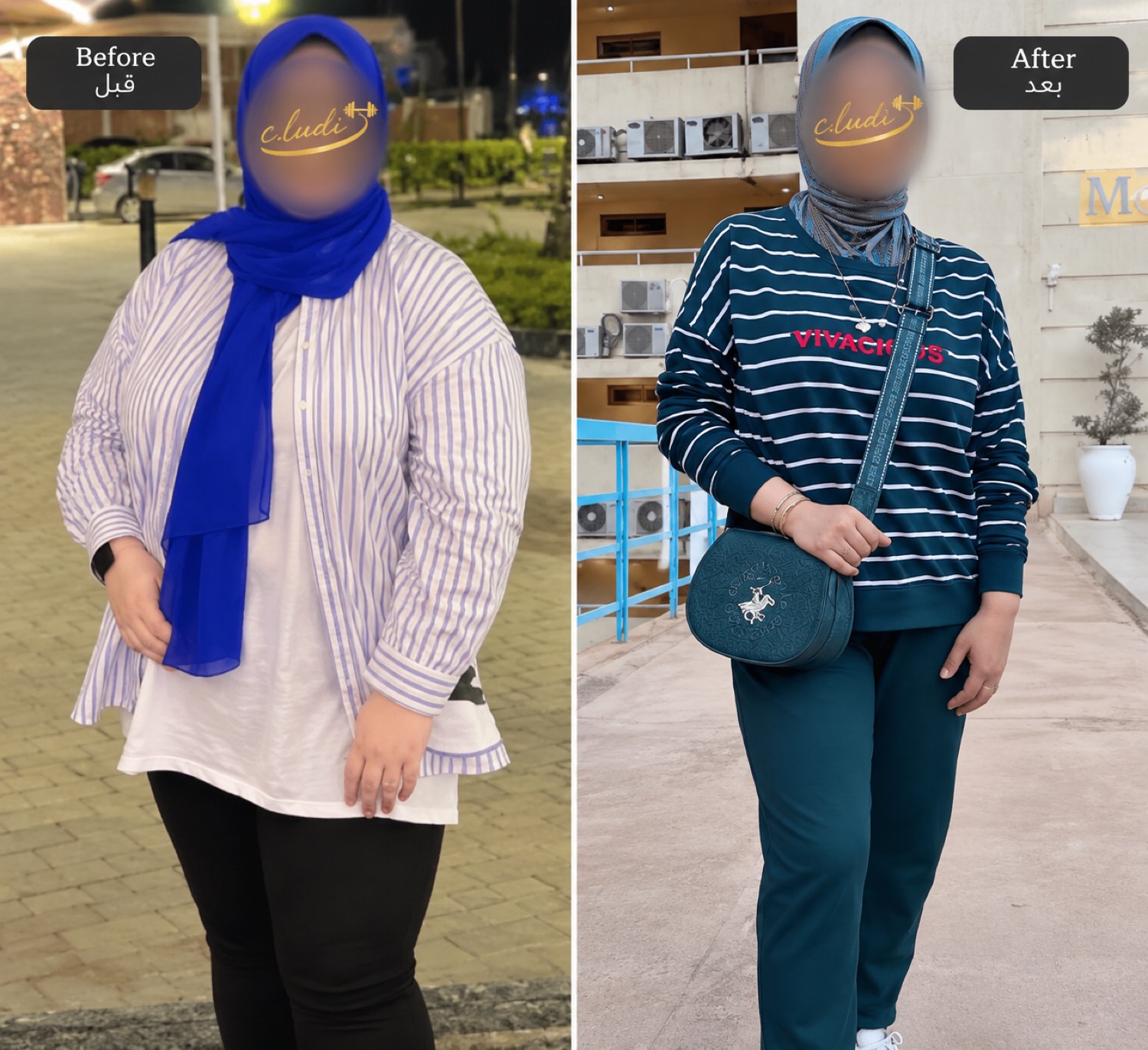 نتيجة قبل وبعد لمتدربة